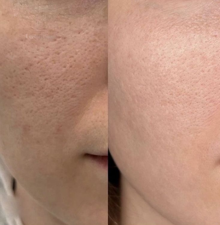 Peel Shot Kojic Acid Turmeric Duo Spay + Serum