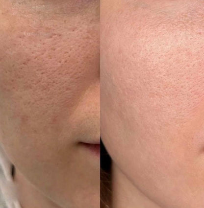 Peel Shot Kojic Acid Turmeric Duo Spay + Serum