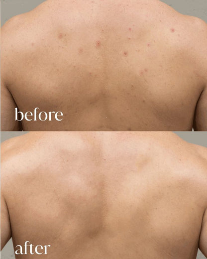 Peel Shot Kojic Acid Turmeric Duo Spay + Serum