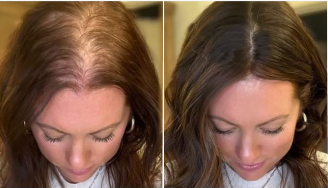 Hair Growth Accelerator Soft Chews