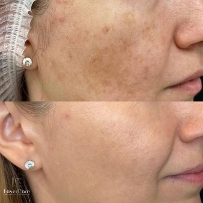 Peel Shot Kojic Acid Turmeric Duo Spay + Serum